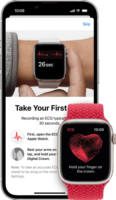 which apple watch takes ekg